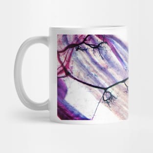 Muscle motor neurones, light micrograph (C007/8436) Mug